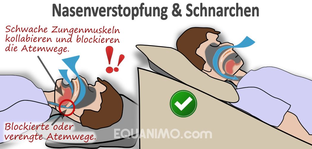 Mittel gegen Reflux, Atemnot &mehr: EZsleep Bettkeil