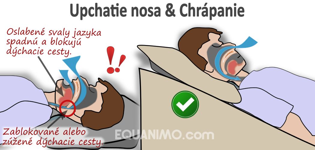 Klin EZsleep zmierňuje príznaky: upchatie nosa, chrápanie a dychacie