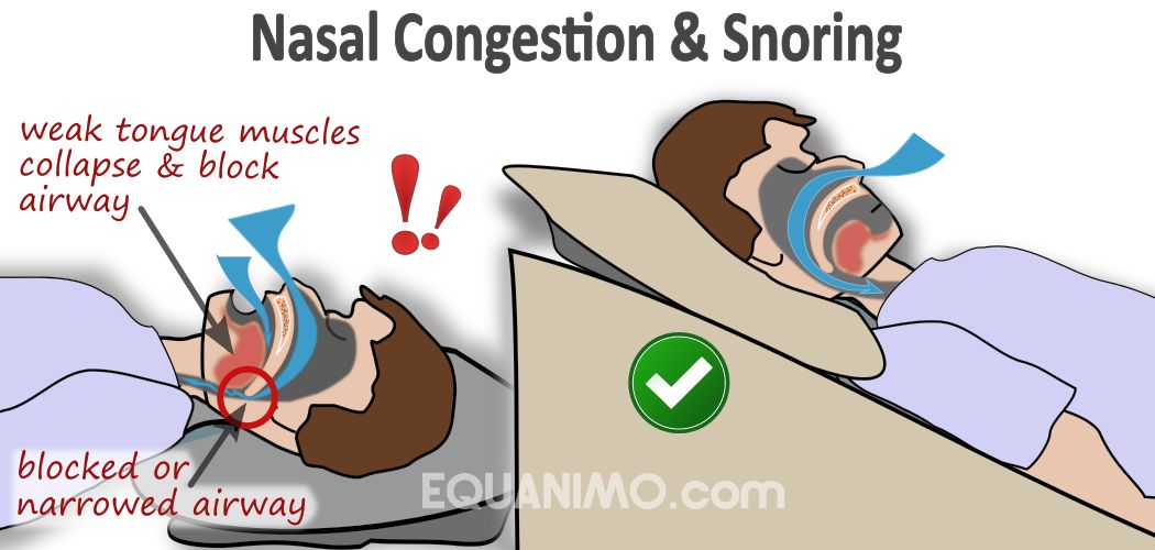 EZsleep Wedge helps promote better breathing during sleeping, hence alleviate nasal congestion and minimize risks of snoring as well as mild sleep apnea