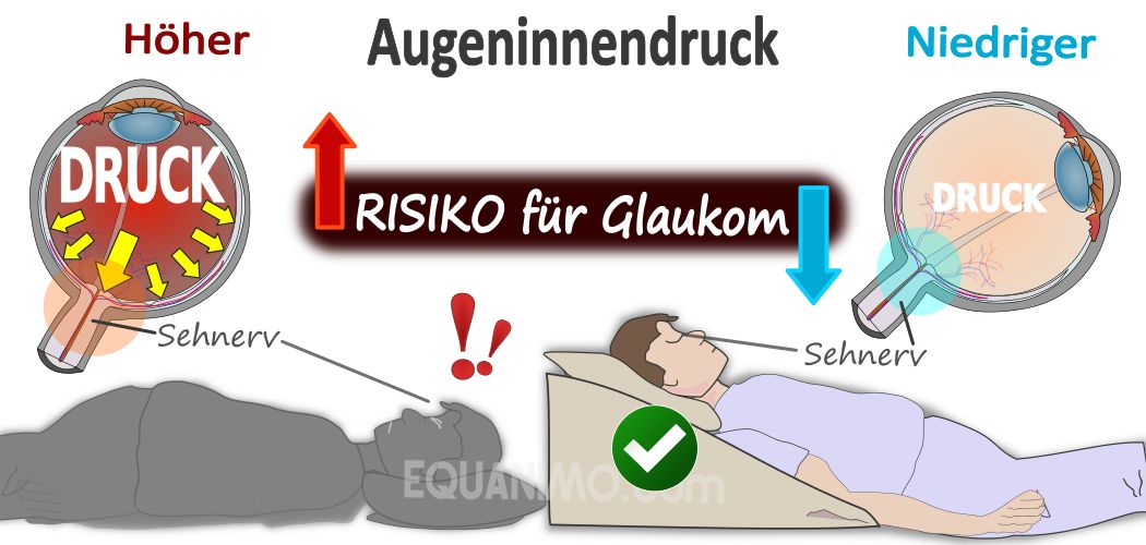 Schlafen auf einem Keil kann senkt Augeninnendruck während des Schlafes